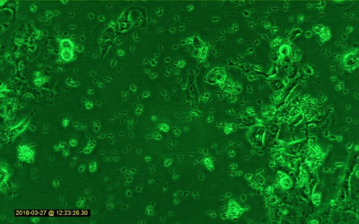Toxoplasma gondii Vero cells (1)             